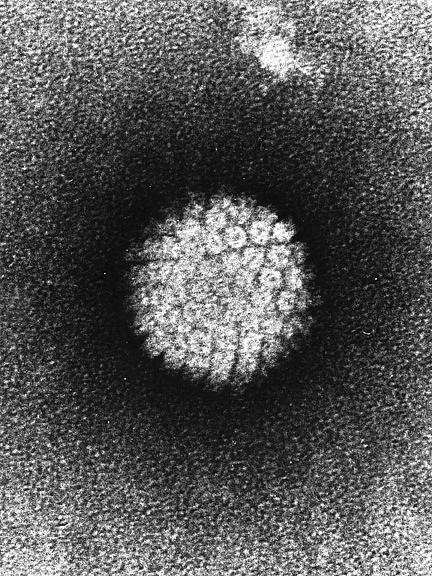 Electron micrograph of a human papillomavirus